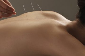 Tout savoir sur l’acupuncture